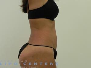 americanlipocenters_64.jpg